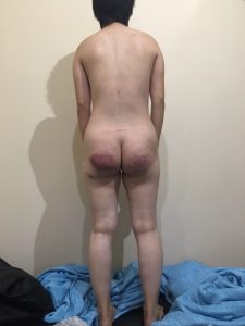 BDSM video Buttocks were blue　尻が青くなった