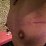 BDSM video Scratch whip　鞭の痕