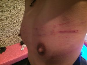BDSM video Scratch whip　鞭の痕