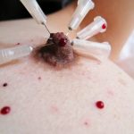 BDSM video nipple with needle ゆきの乳首に針