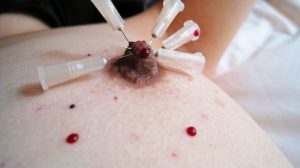 BDSM video nipple with needle ゆきの乳首に針