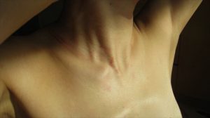 BDSM video It rubbed marks of rope 縄の擦れた痕