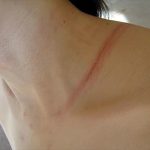 BDSM video It rubbed marks of rope 縄の擦れた痕