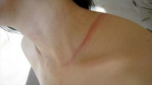 BDSM video It rubbed marks of rope 縄の擦れた痕